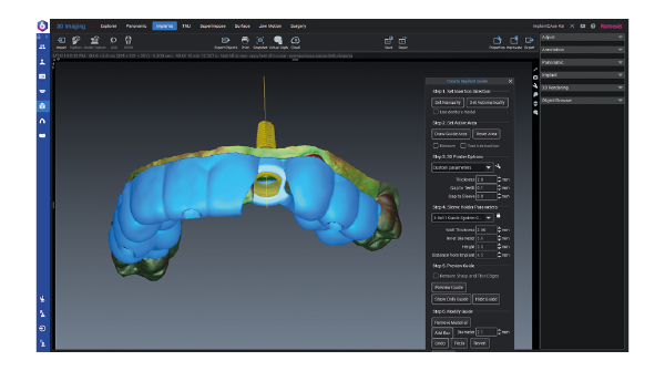 Romexis 3D Implant Guide module